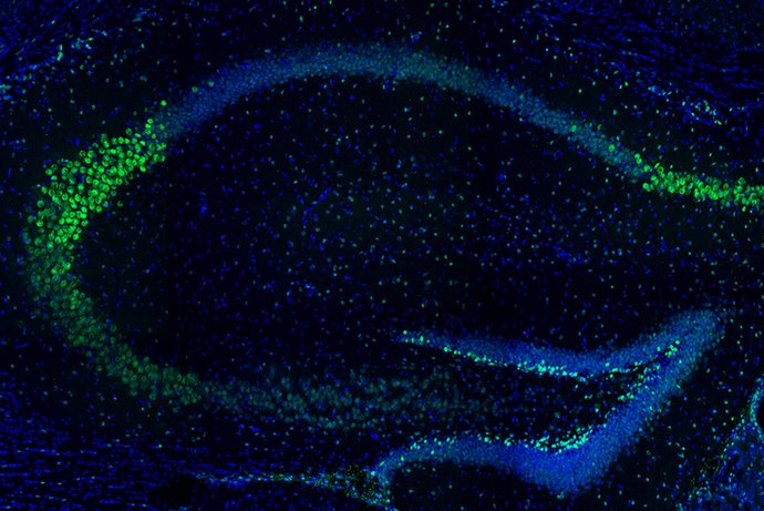  International Research Team with Participation from MU&ndash;Varna Proposes New Treatment for a Rare Genetic Syndrome